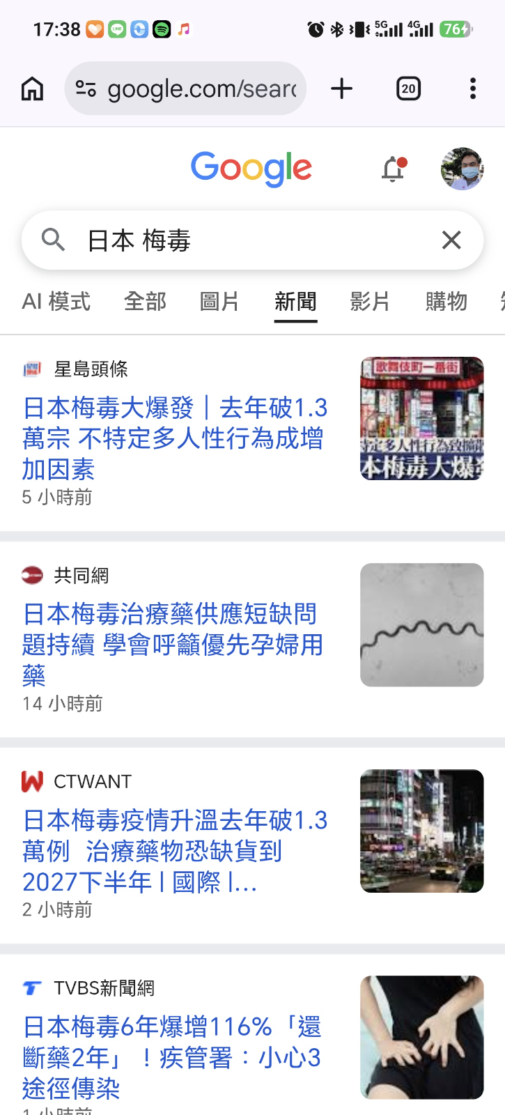 [圖]