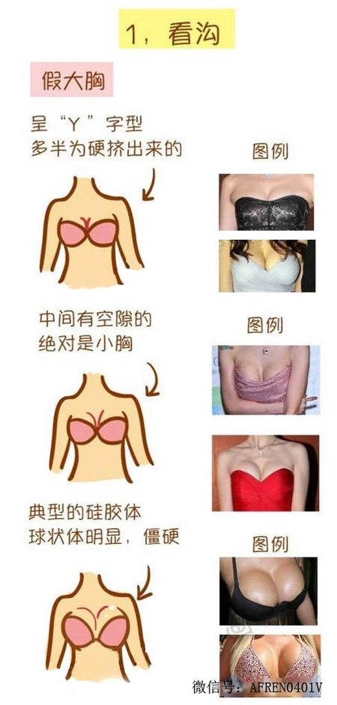 [圖]